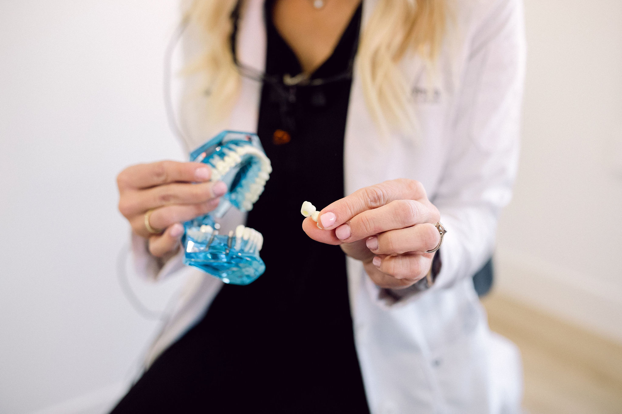Dental Fillings 2